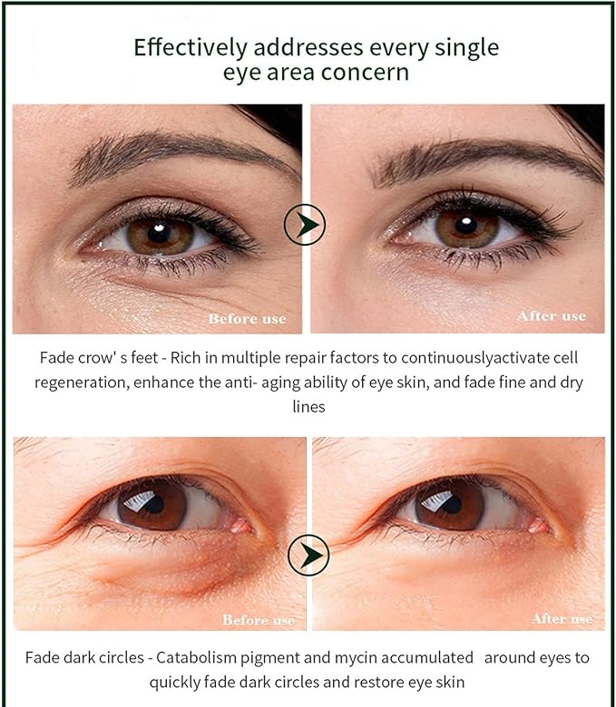 Time Eraser Eye Essence Oil