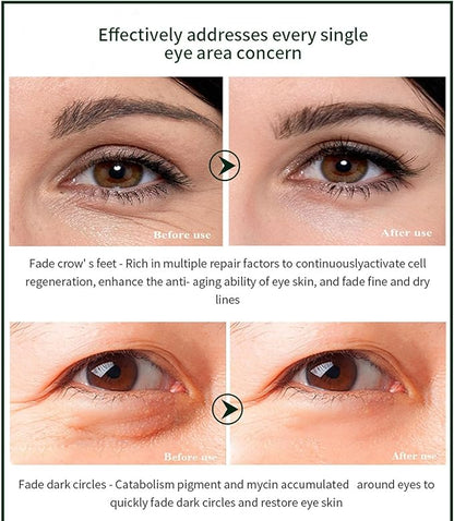 Time Eraser Eye Essence Oil